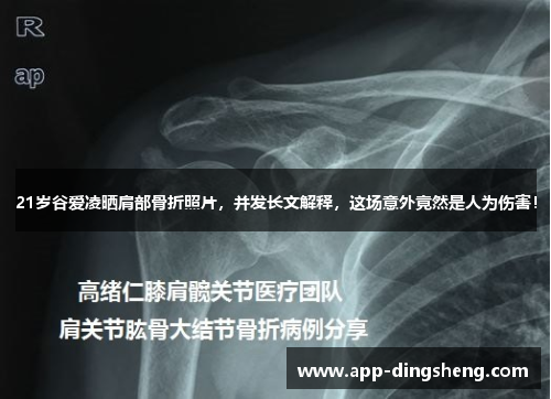 21岁谷爱凌晒肩部骨折照片，并发长文解释，这场意外竟然是人为伤害！